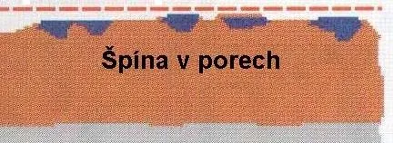 spina-v-porech